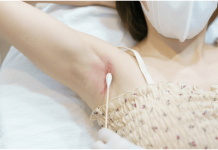 What You Need To Know About SRT and Keloid Scar Removal Keloid Scar Removal