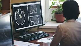 Reliable Neurological Care in Camarillo: A Local Guide to Brain and Nerve Health neurologist camarillo ca